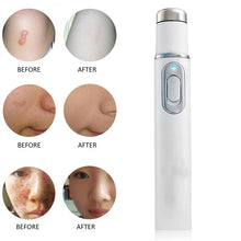 Load image into Gallery viewer, Light Therapy Acne Pen